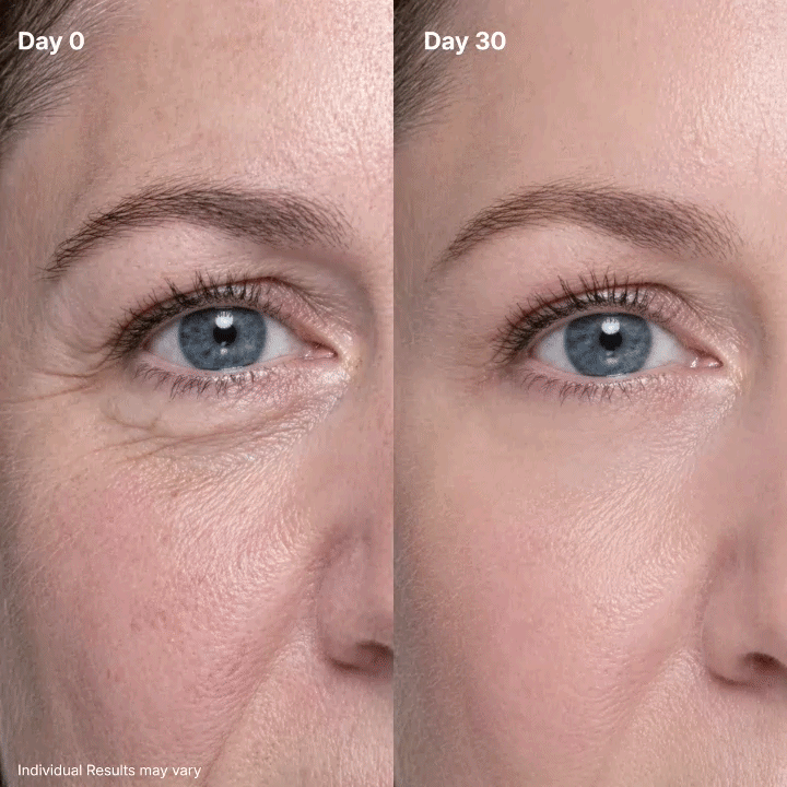 AMPI P7™ Eye Renewal Crème